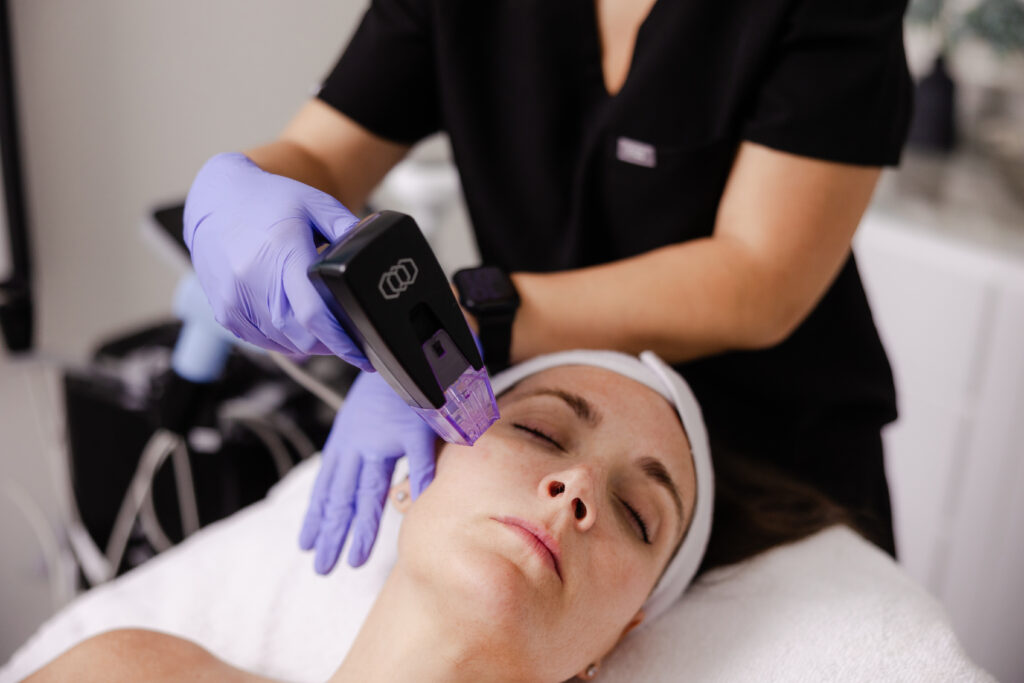 IPL Therapy in RIchmond, VA

