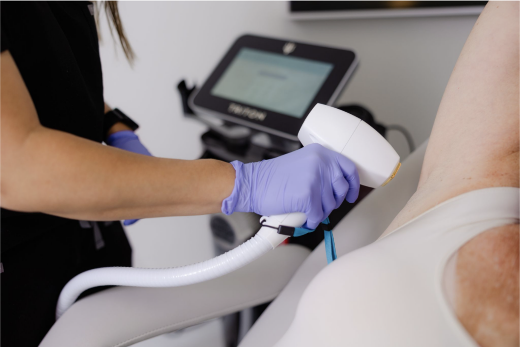 Laser Hair Removal Richmond VA